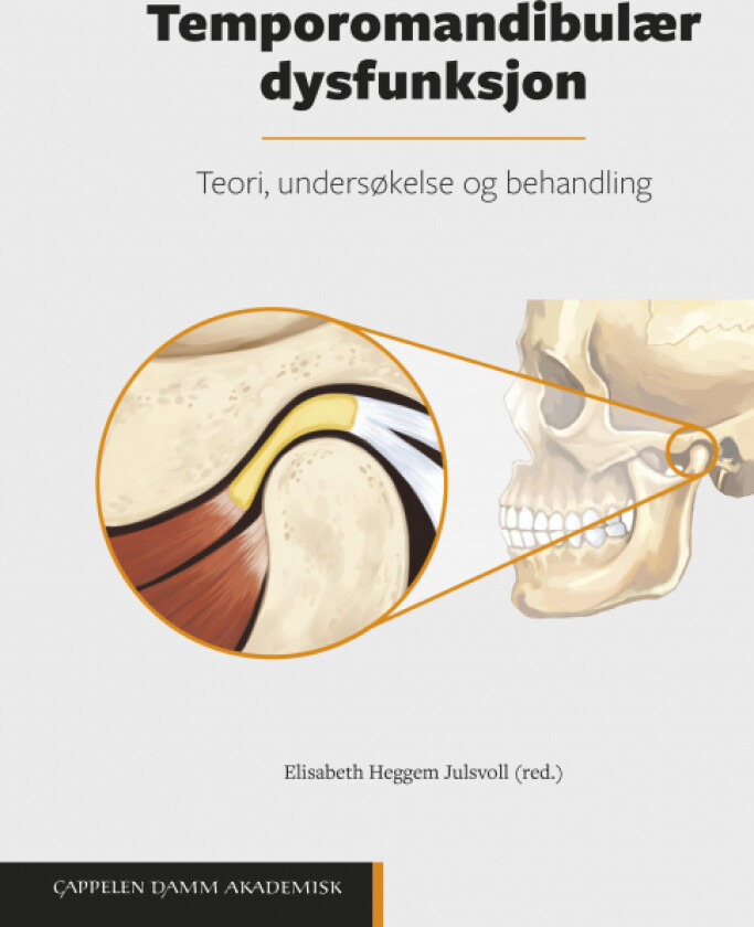 Temporomandibulær dysfunksjon