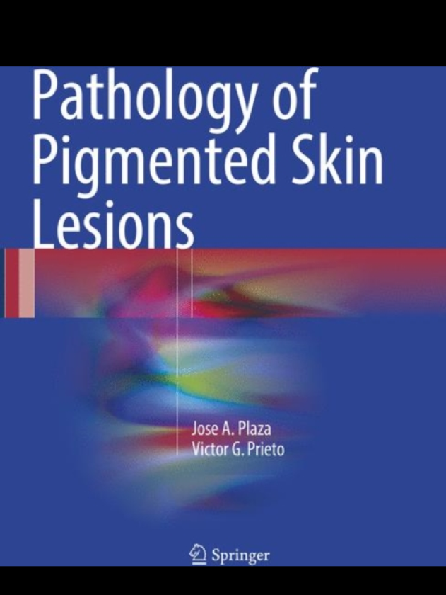 Pathology of Pigmented Skin Lesions