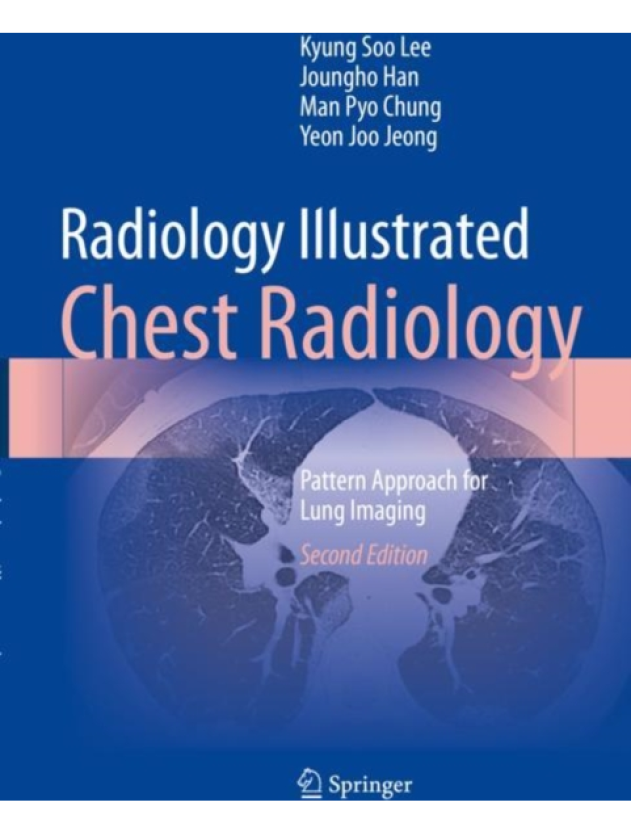 Radiology Illustrated: Chest Radiology Pattern Approach for Lung Imaging