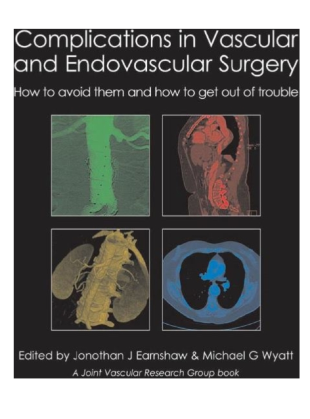 Complications in Vascular and Endovascular Surgery How to avoid them and how to get out of trouble