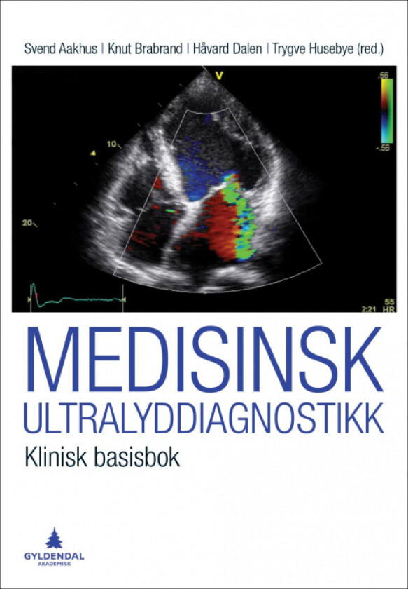 Medisinsk ultralyddiagnostikk