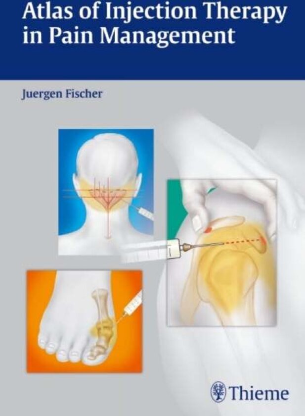 Atlas of Injection Therapy in Pain Management av Jurgen Fischer