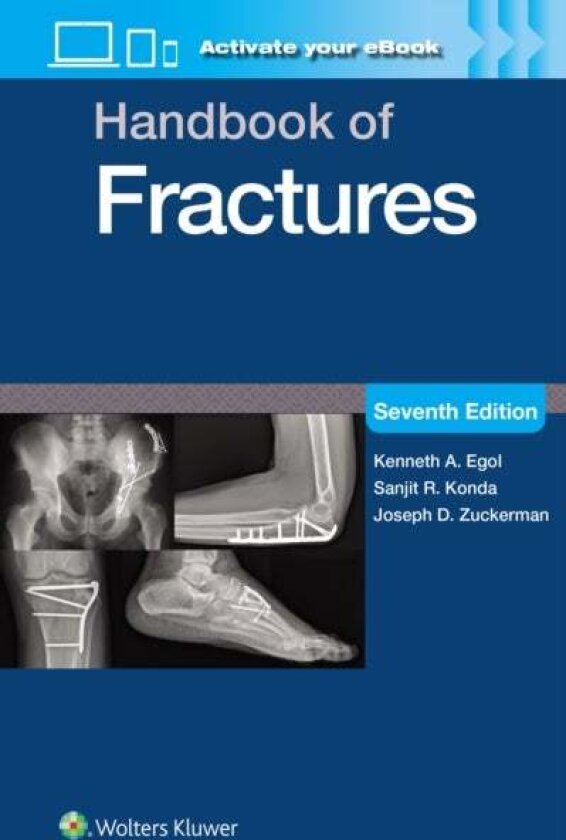 Handbook of Fractures: Print + eBook with Multimedia av KENNETH A., MD EGOL