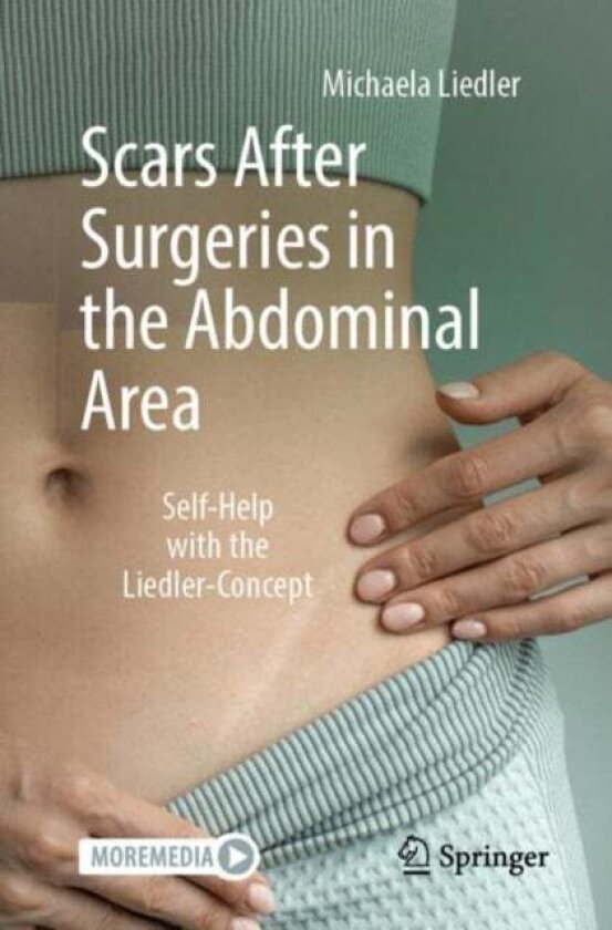 Scars After Surgeries in the Abdominal Area av Michaela Liedler