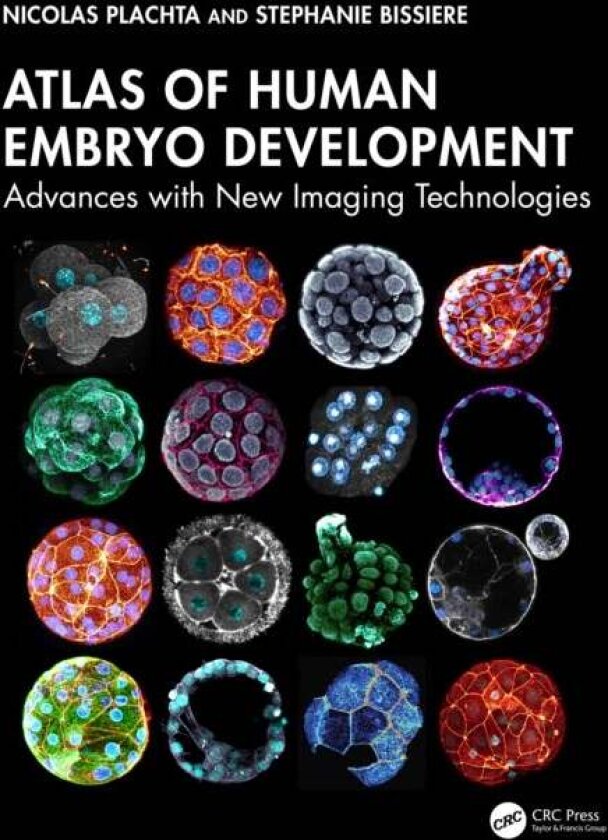 Atlas of Human Embryo Development av Nicolas Plachta