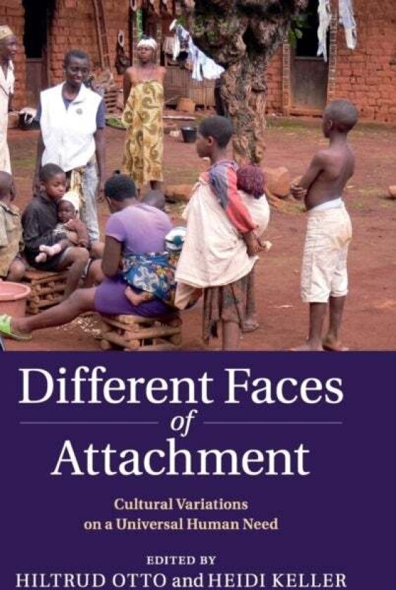 Different Faces of Attachment