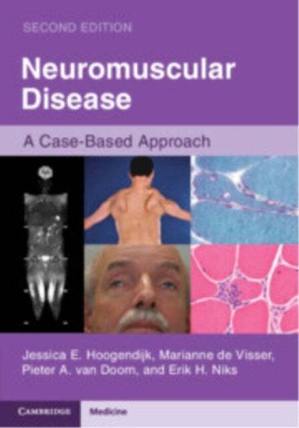 Neuromuscular Disease av Erik H. Niks