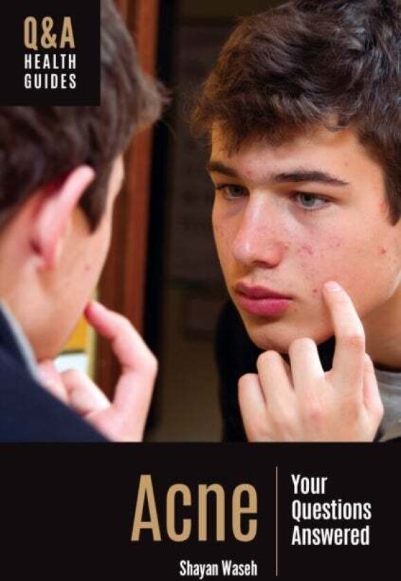 Acne av Shayan Waseh