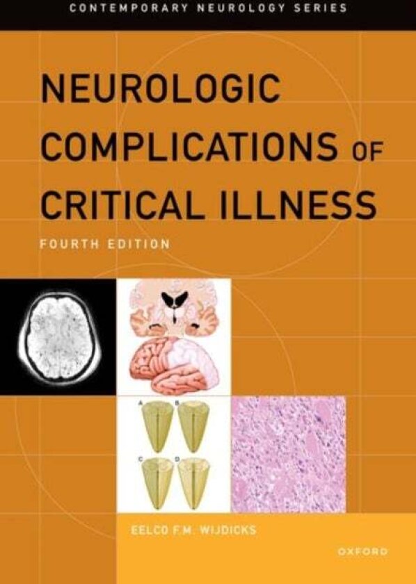 Neurologic Complications of Critical Illness av Eelco F.M. Wijdicks