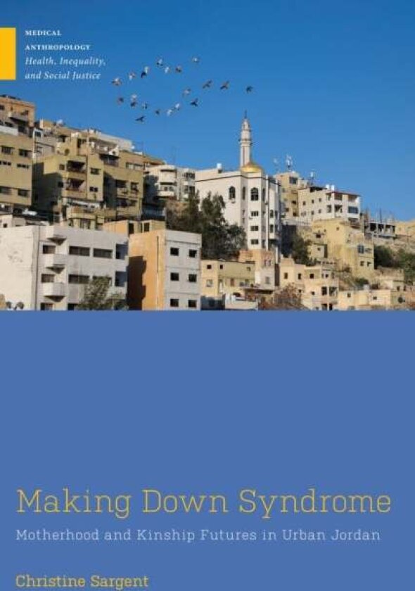Making Down Syndrome av Christine Sargent