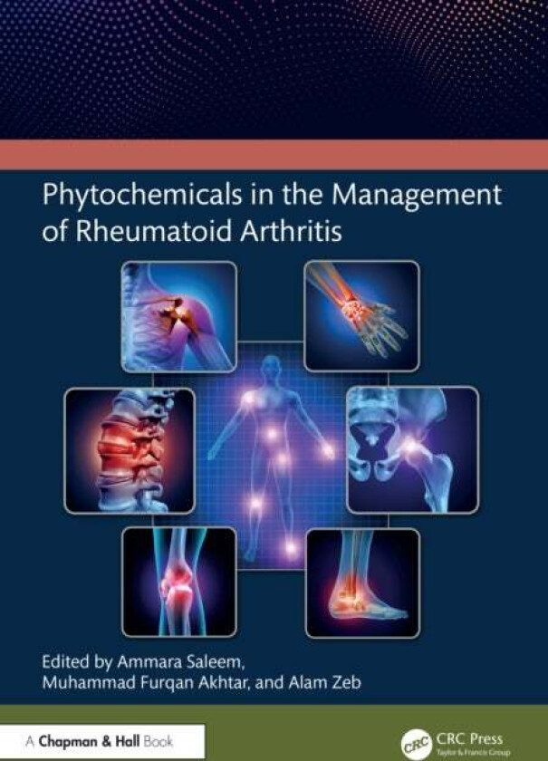 Phytochemicals in the Management of Rheumatoid Arthritis