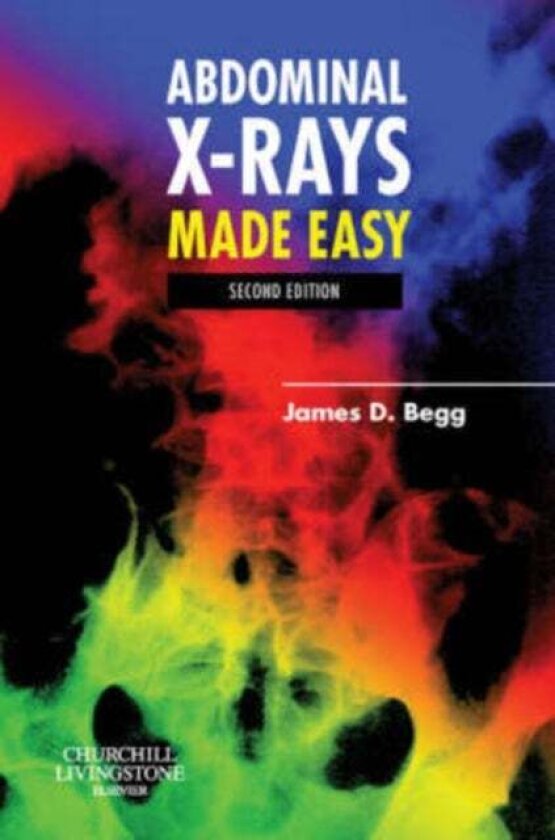 Abdominal X-Rays Made Easy av James D., MB, BS, FRCR Begg