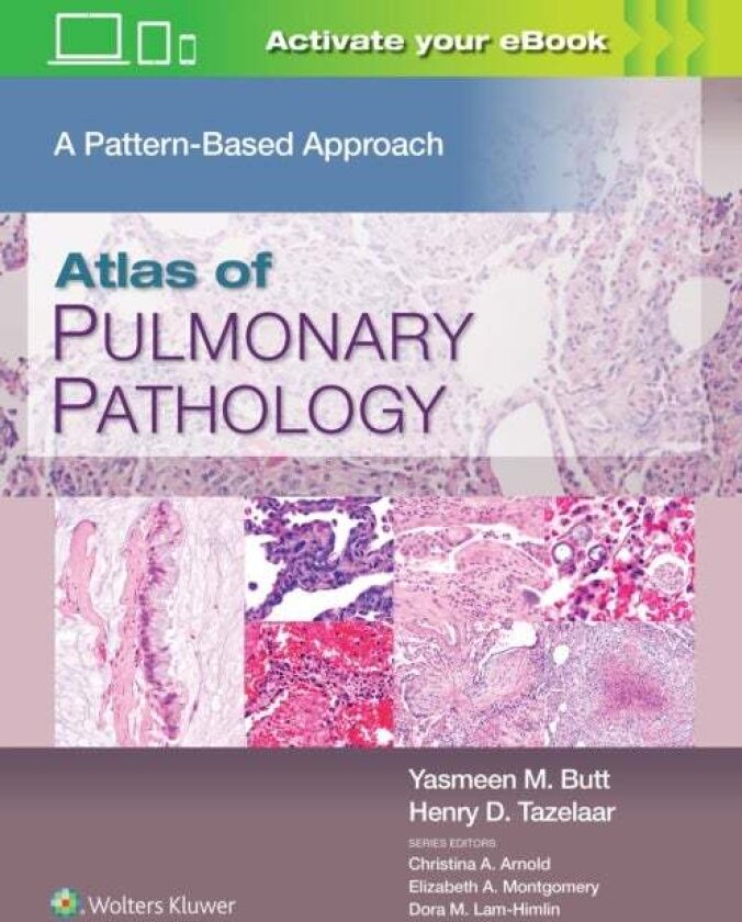 Atlas of Pulmonary Pathology av Henry D., MD Tazelaar