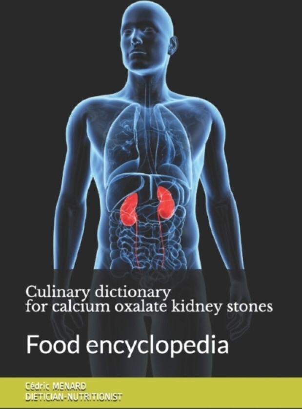 Culinary dictionary for calcium oxalate kidney stones av Cedric Menard (Paperback)