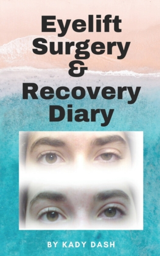 Eyelift Surgery and Recovery Diary av Kady Dash (Paperback)