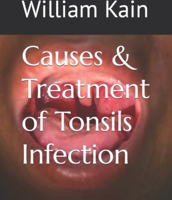 Causes & Treatment of Tonsils Infection av William Kain (Paperback)