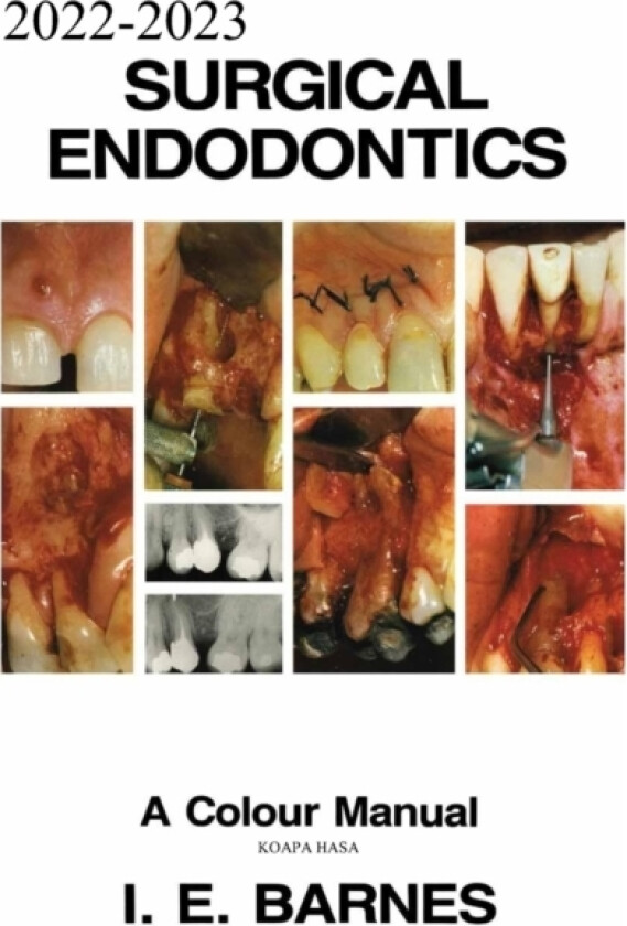 2022-2023 Surgical Endodontics av Koapa Hasa (Paperback)