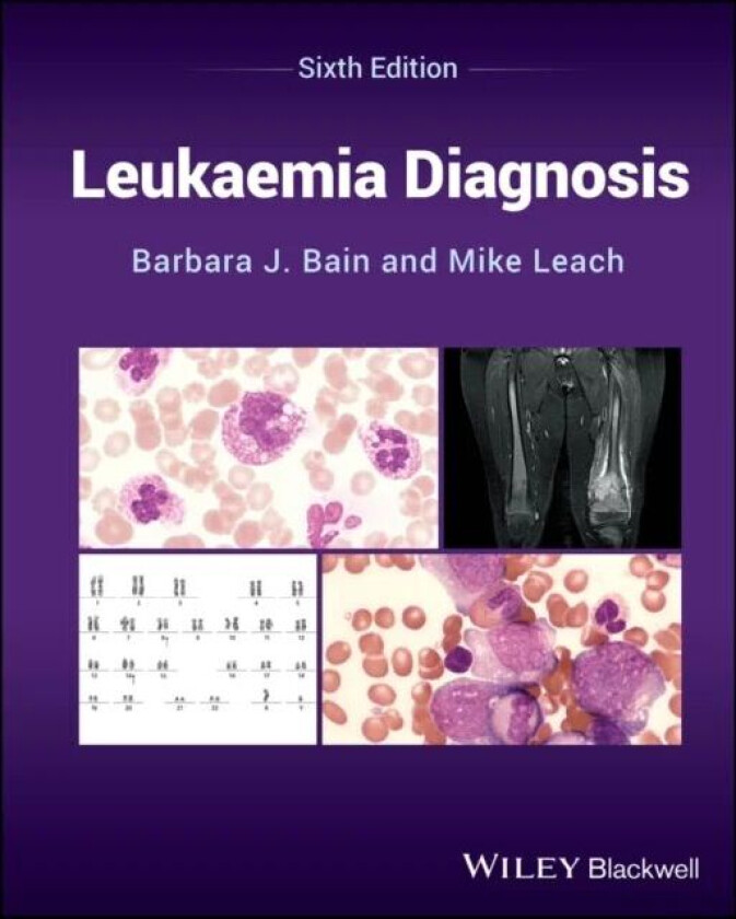 Leukaemia Diagnosis Av Barbara J. (St Mary'S Hospital London Uk) Bain, Mike (Gartnavel General Hospital Glasgow Uk) Leach