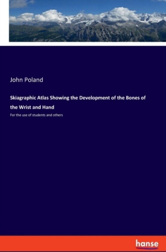 Skiagraphic Atlas Showing the Development of the Bones of the Wrist and Hand av John Poland (Paperback)