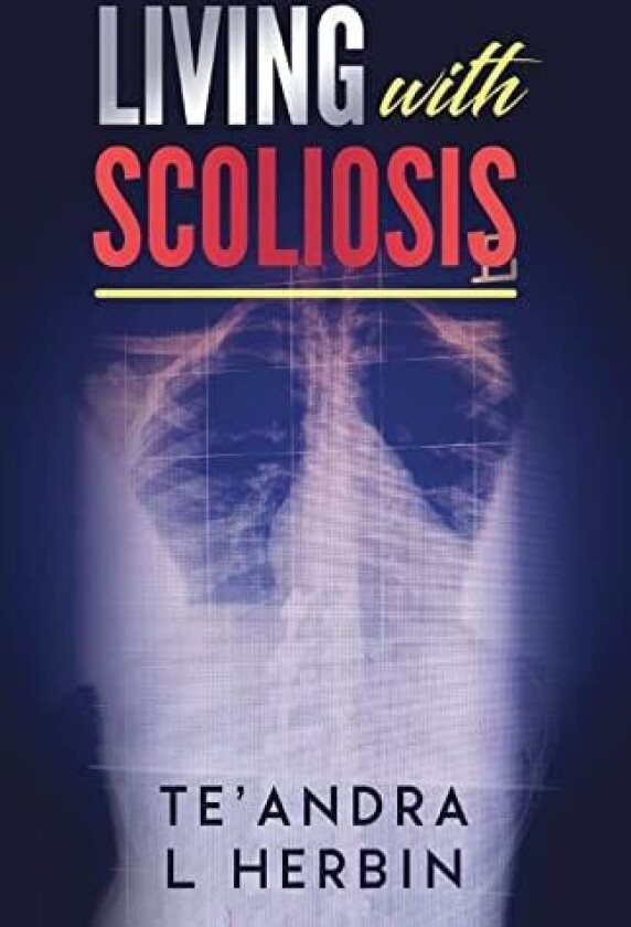 Living With Scoliosis av Te'andra Herbin (Paperback)