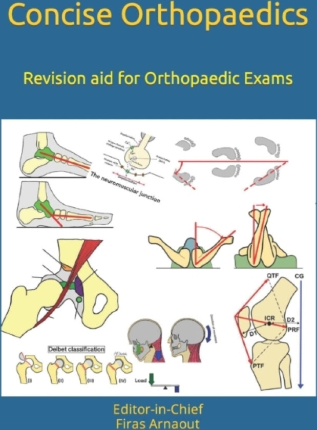 Concise Orthopaedic Notes av Firas Arnaout Frcs (Paperback)