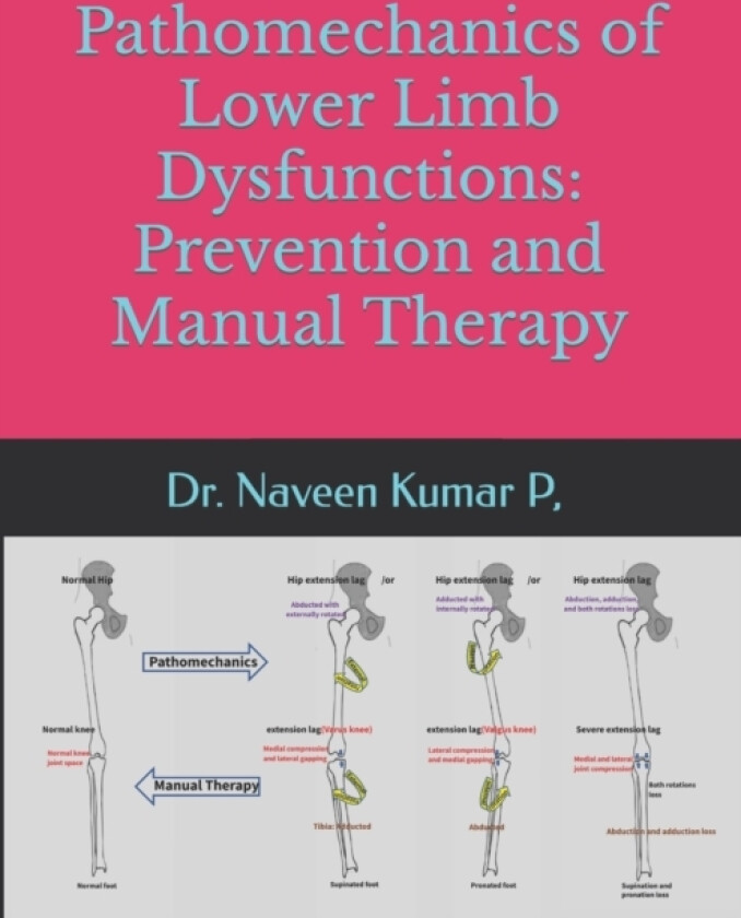 Pathomechanics of Lower limb dysfunctions av Naveen Kumar P (Paperback)