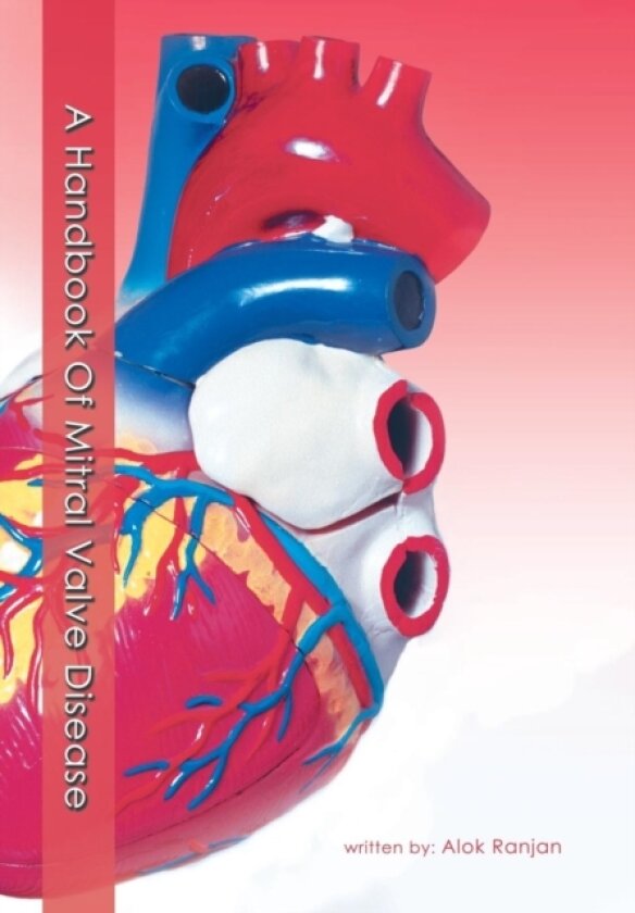 A Handbook Of Mitral Valve Disease av Alok Ranjan (Hardcover)