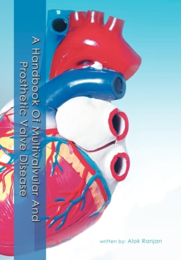 A Handbook Of Multivalvular and Prosthetic Valve Disease av Alok Ranjan (Hardcover)
