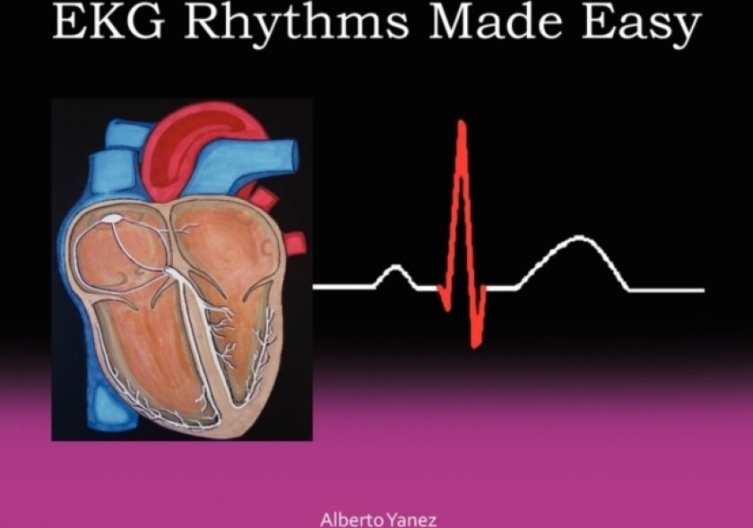 EKG Rhythms Made Easy av Alberto Yanez (Paperback)