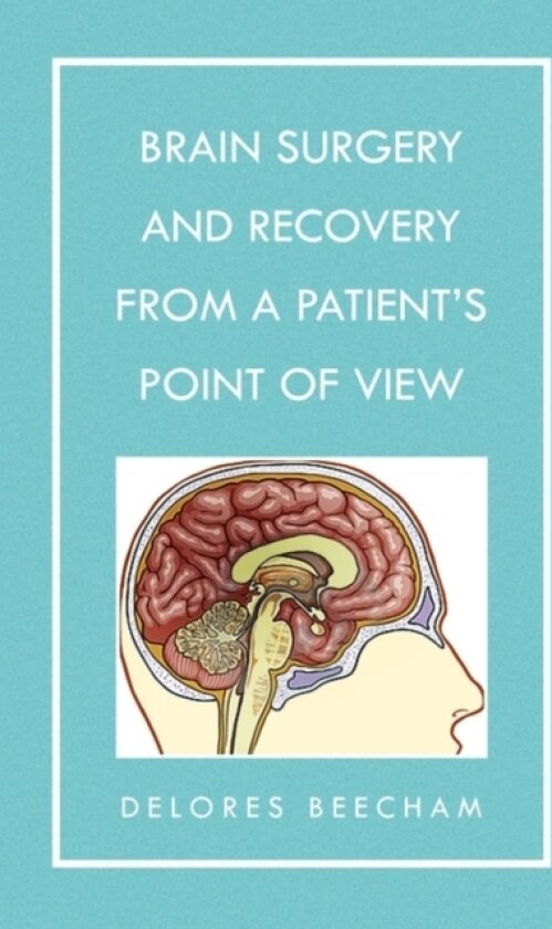Brain Surgery and Recovery from a Patient's Point of View av Delores Beecham (Paperback)