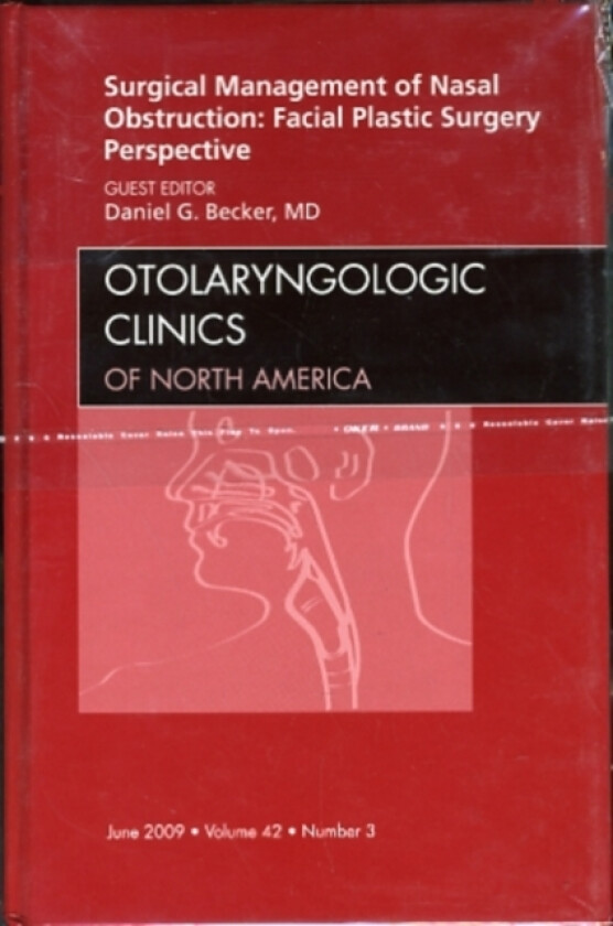 Surgical Management of Nasal Obstruction: Facial Plastic Surgery Perspective, An Issue of Otolaryngologic Clinics av Daniel G. MD Becker (Hardcover)