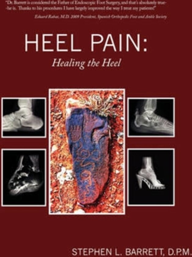 Heel Pain av D.P.M.Stephen L. Barrett (Paperback)