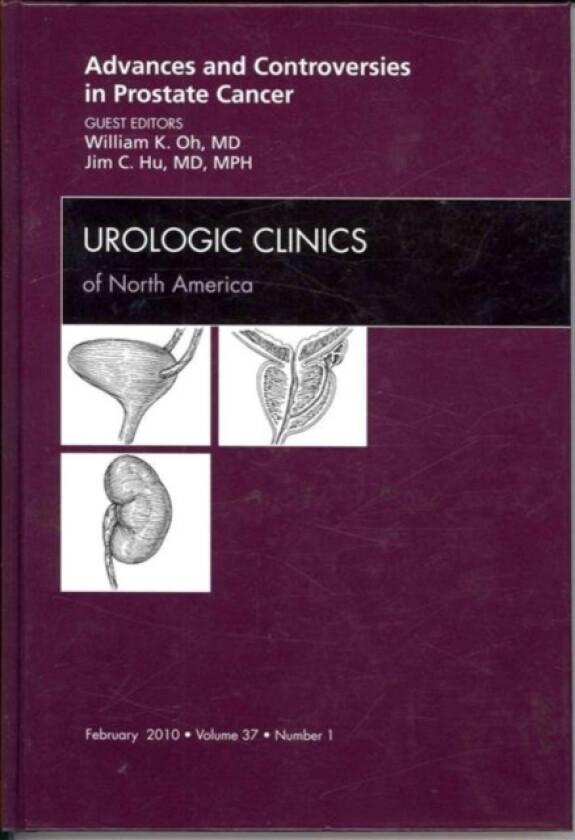Advances and Controversies in Prostate Cancer, An Issue of Urologic Clinics av William K. Oh, James C. Hu (Hardcover)