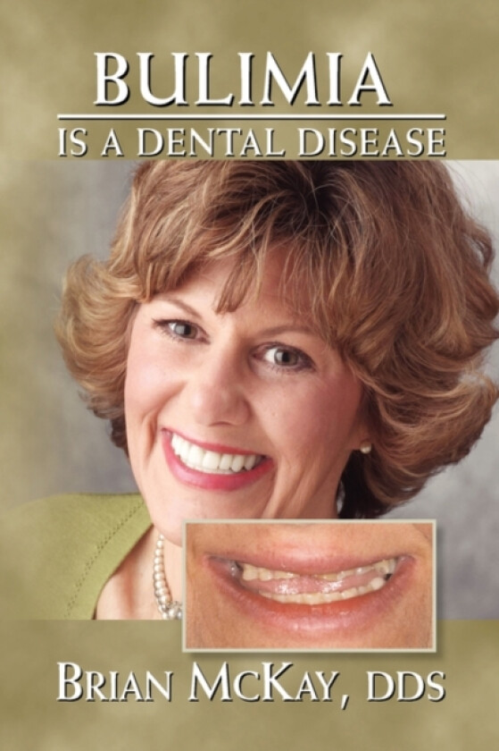 Bulimia Is a Dental Disease av Brian Dds McKay (Paperback)