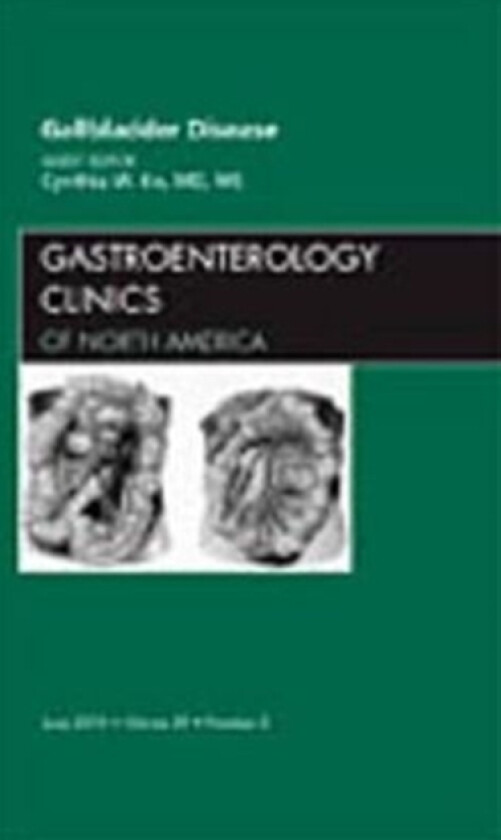 Gallbladder Disease, An Issue of Gastroenterology Clinics av Cynthia W. Ko (Hardcover)