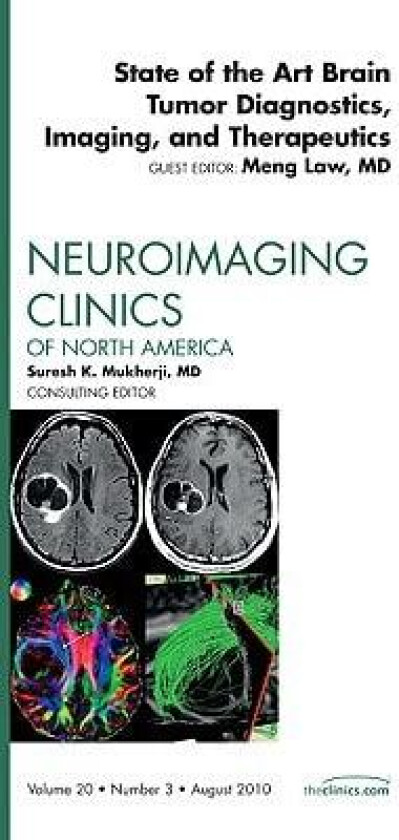 State of the Art Brain Tumor Diagnostics, Imaging, and Therapeutics, An Issue of Neuroimaging Clinics av Meng Law (Hardcover)