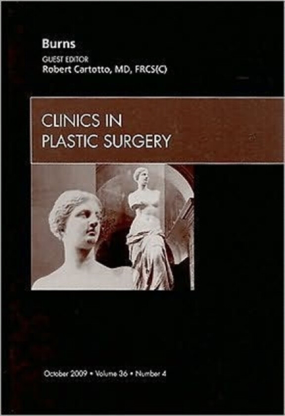 Burns, An Issue of Clinics in Plastic Surgery av Robert Cartotto (Hardcover)