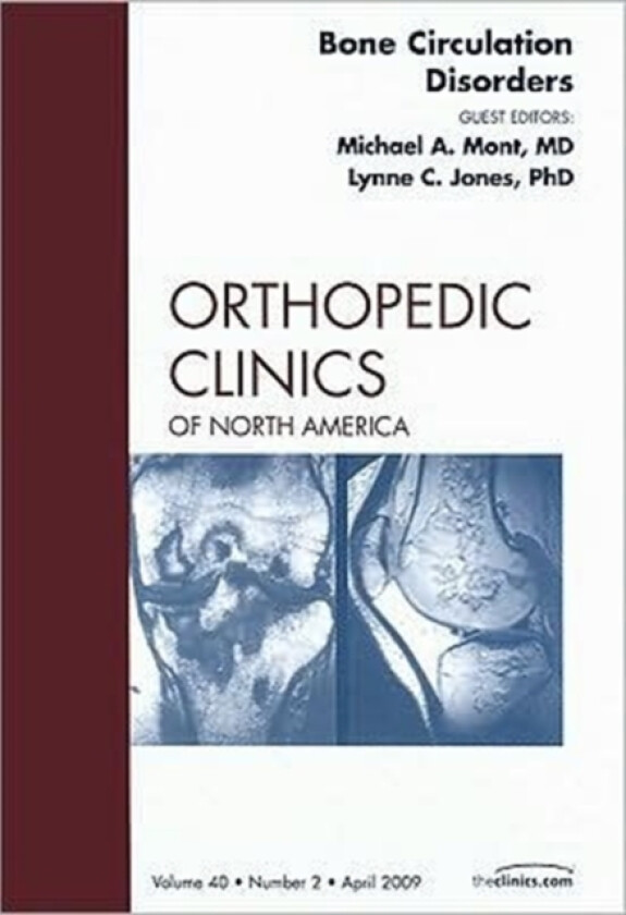 Bone Circulation Disorders, An Issue of Orthopedic Clinics av Michael A. Mont, Lynne C. Jones (Hardcover)