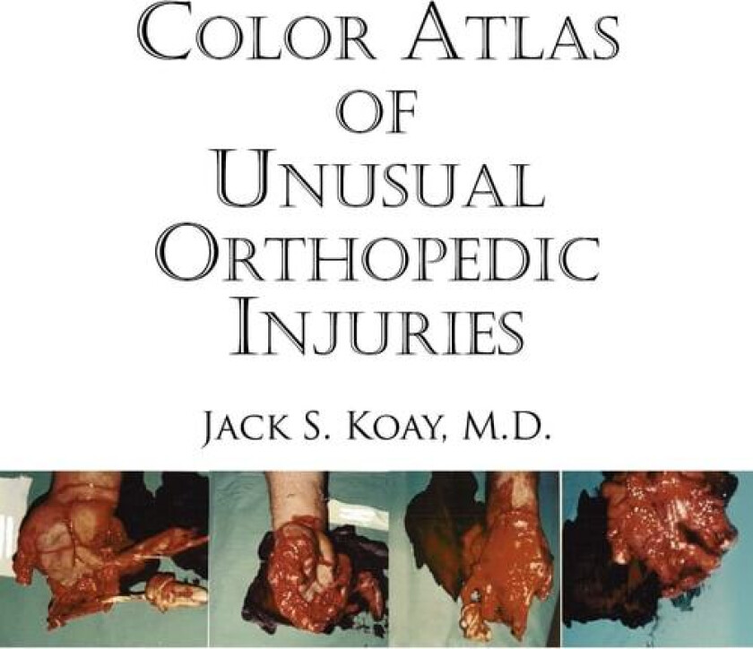 Color Atlas Of Unusual Orthopedic Injuries av Jack Koay (Paperback)