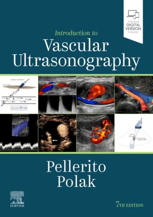 Introduction to Vascular Ultrasonography av John S. MD FACR FSRU FAIUM (Associate Professor of Radiology Hofstra North Shore-LIJ School of Medicine As
