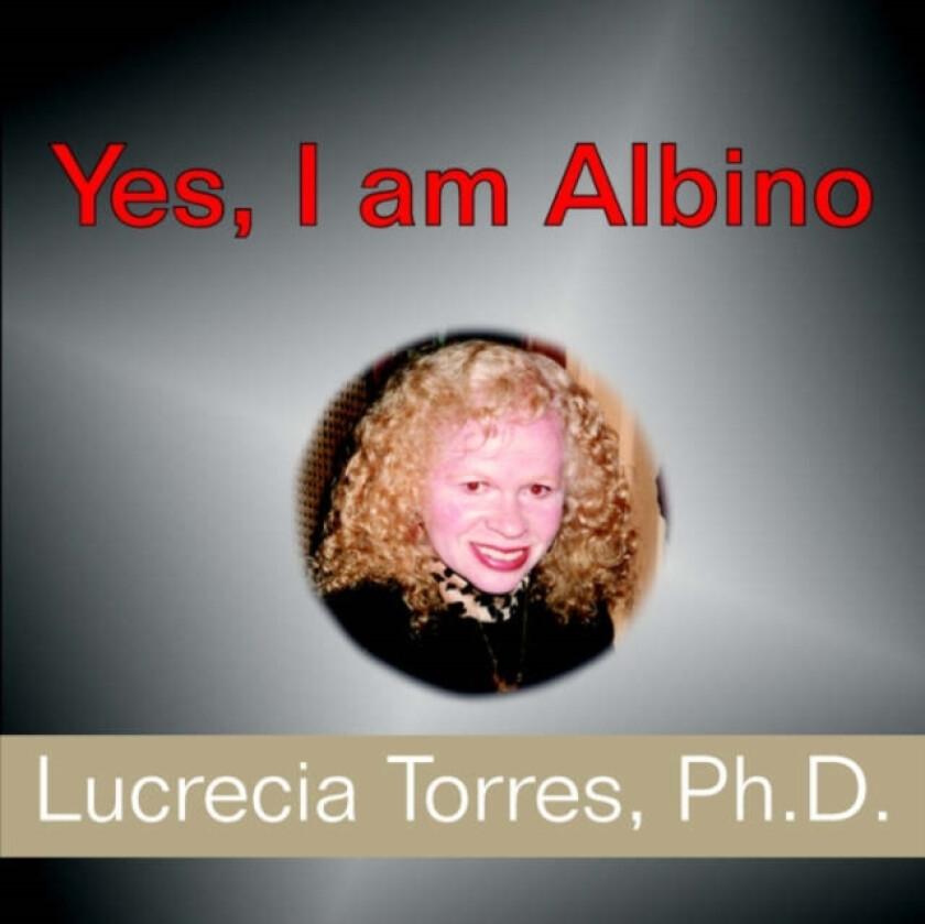 Yes, I am Albino av Lucrecia Torres (Paperback)