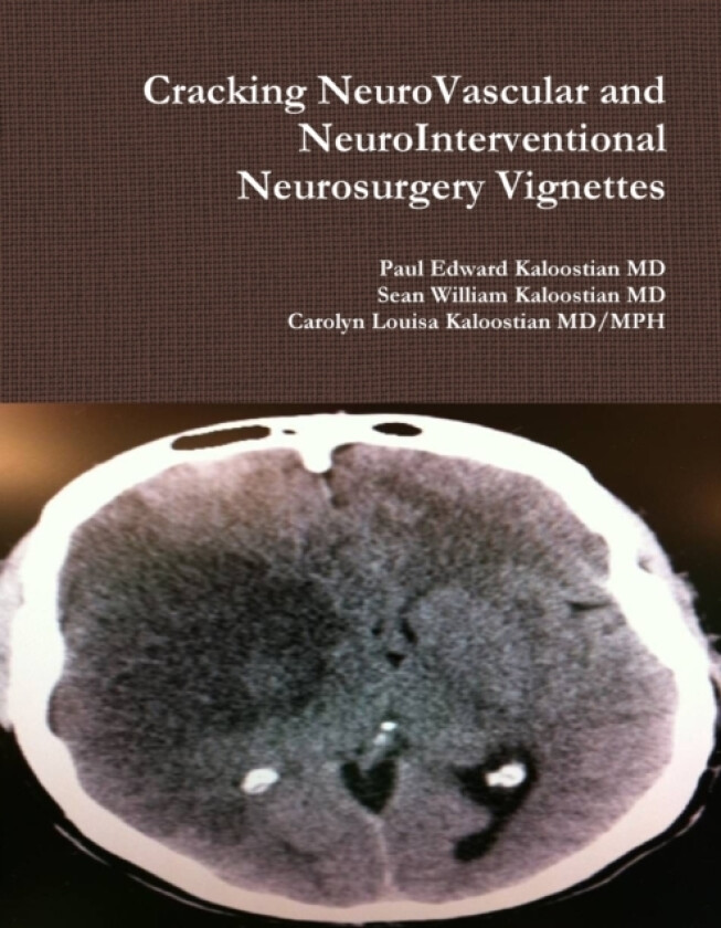 Cracking NeuroVascular and NeuroInterventional Neurosurgery Vignettes av Paul Edward MD Kaloostian, Carolyn Louisa Kaloostian MD/Mph, Sean William MD Kaloostian (Paperback)