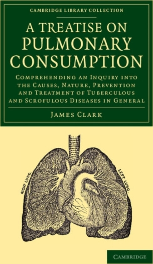 A Treatise on Pulmonary Consumption av James Clark (Paperback)