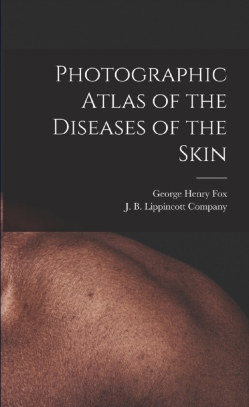 Photographic Atlas of the Diseases of the Skin av George Henry Fox (Paperback)