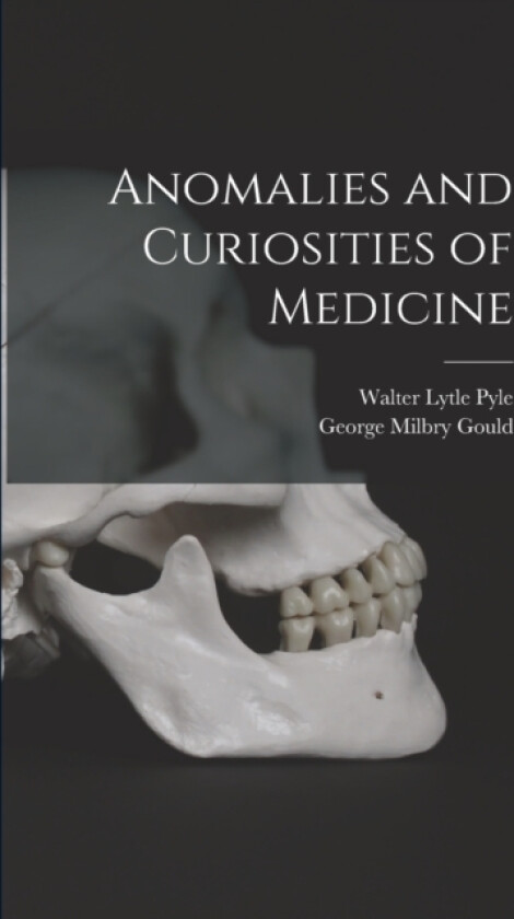 Anomalies and Curiosities of Medicine av George Milbry Gould, Walter Lytle Pyle (Paperback)