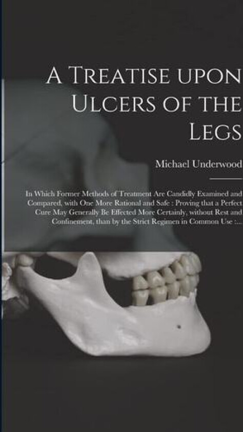 A Treatise Upon Ulcers of the Legs av Michael 1736-1820 Underwood (Paperback)