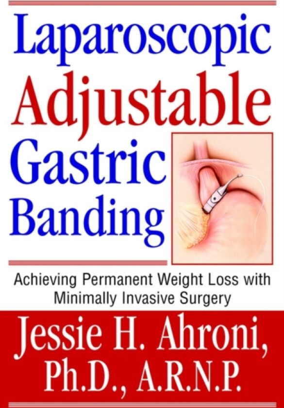 Laparoscopic Adjustable Gastric Banding av Jessie Ahroni (Hardcover)