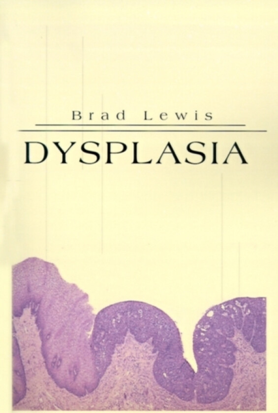 Dysplasia av Brad B Lewis (Paperback)