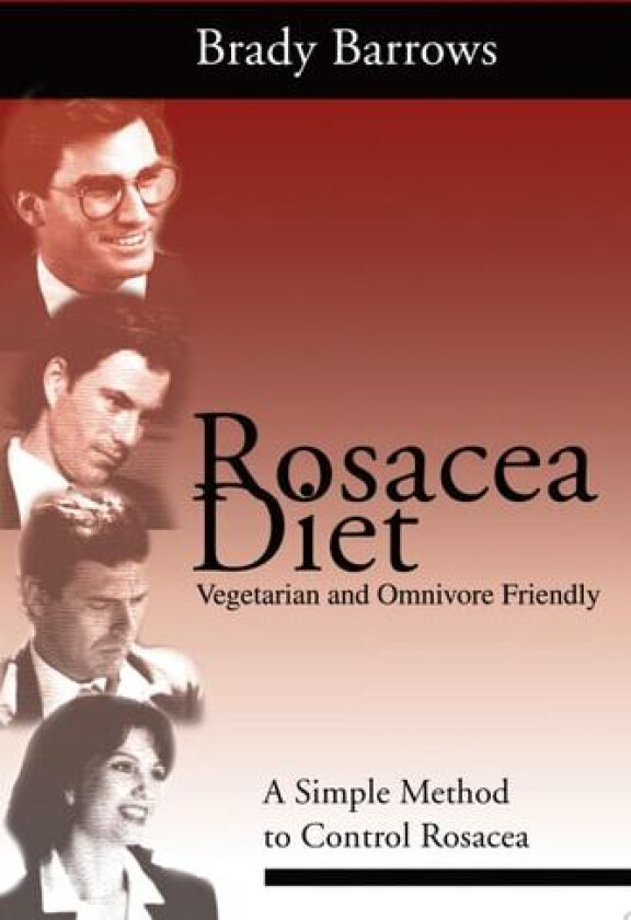 Rosacea Diet av Brady Barrows (Paperback)