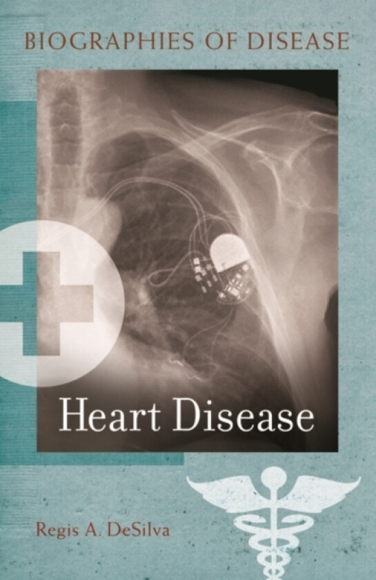 Heart Disease av Regis A.de Silva (Hardcover)